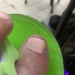A bad pedicure A bad pedicure