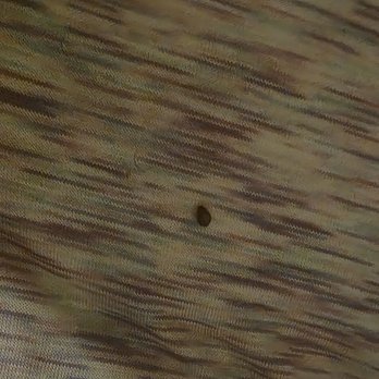 The Pavilion - Bed bug - Apartments Near Me - Chicago, Illinois The Pavilion - Bed bug - Apartments Near Me - Chicago, Illinois