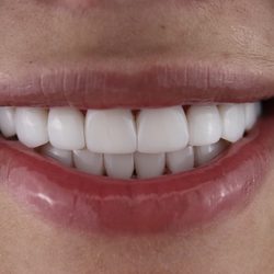 Smile Dental Center