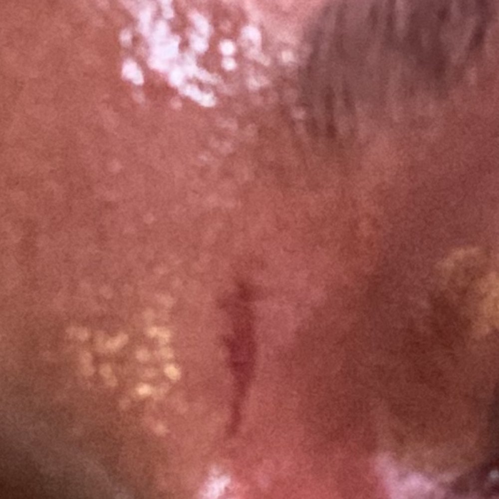 Nail Pro - These are the pictures from how they burnt my face with the wax because they rush. - Nail Salons Near Me - Poughkeepsie, New York