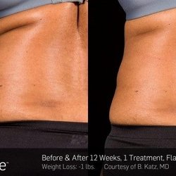 New Life Wellness and Medical Spa