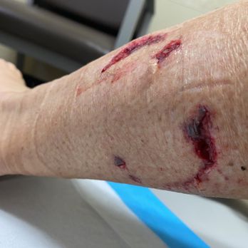 8-2-8 Urgent care - OUCHY!!! - Urgent Care Near Me - Oceanside, California 8-2-8 Urgent care - OUCHY!!! - Urgent Care Near Me - Oceanside, California