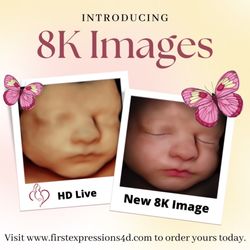 First Expressions Ultrasound