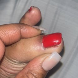 Horrible Pedicure