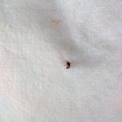 Lakeside Inn - Bed bug