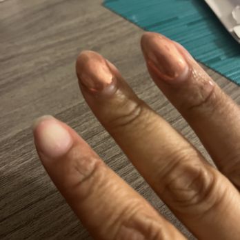 Pure Nails Spa - A week and a half later, nail comes completely off! - Nail Salons Near Me - Alexandria, Virginia Pure Nails Spa - A week and a half later, nail comes completely off! - Nail Salons Near Me - Alexandria, Virginia