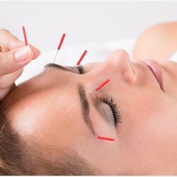Ocean Acupuncture & Herbal Medicine