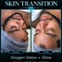 Holistic Perfect Skin