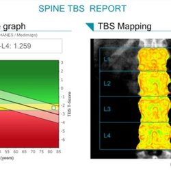 Body Analytics