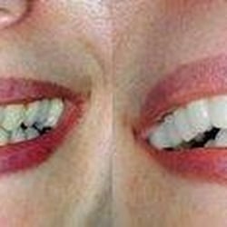 Acton Family Dental Care