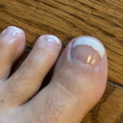 Nail Trix & Spa - Messy paint and chunk out of my toe