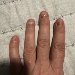I god fungus from this nail salon I god fungus from this nail salon