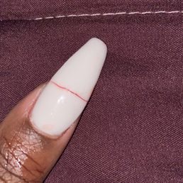 Other hand , nail took off half of my real nail , same as other thimb