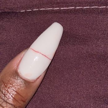 Nailtrap - Other hand , nail took off half of my real nail , same as other thimb - Nail Salons Near Me - Decatur, Georgia