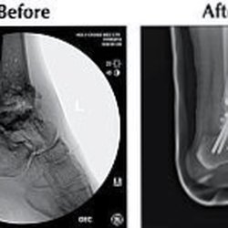 Los Angeles Institute of Foot and Ankle Surgery