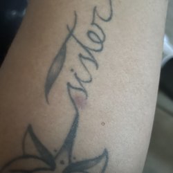 Inland Empire Occupational Medicine - This is my recheck and as you see it left a bruise and I complain
