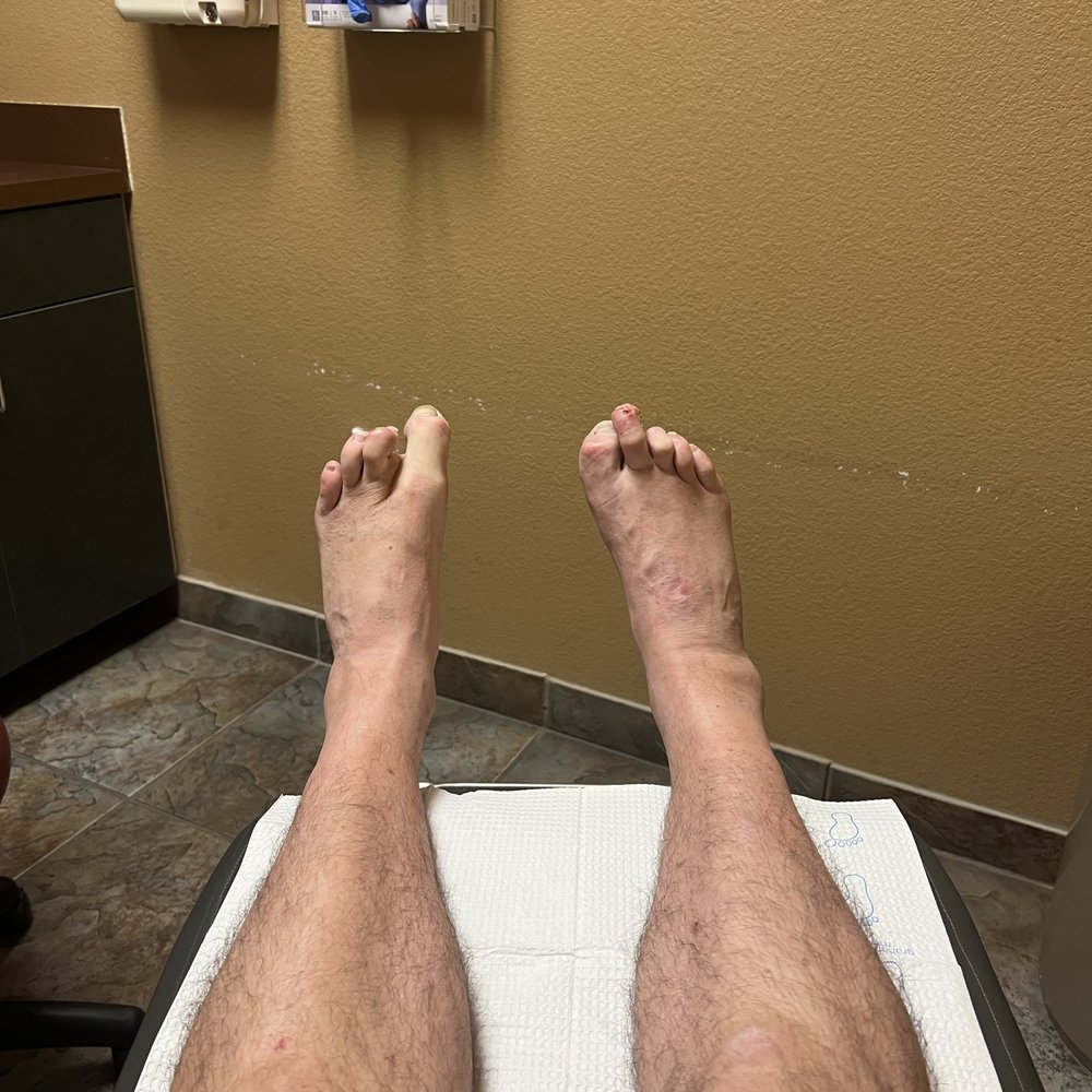 OrthoArizona - Mesa - CMT sucks! - Orthotics Near Me - Mesa, Arizona OrthoArizona - Mesa - CMT sucks! - Orthotics Near Me - Mesa, Arizona