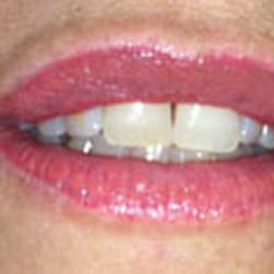 Theresa Wild Permanent Cosmetics - Before lip Treatment