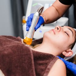 InSkin Laser