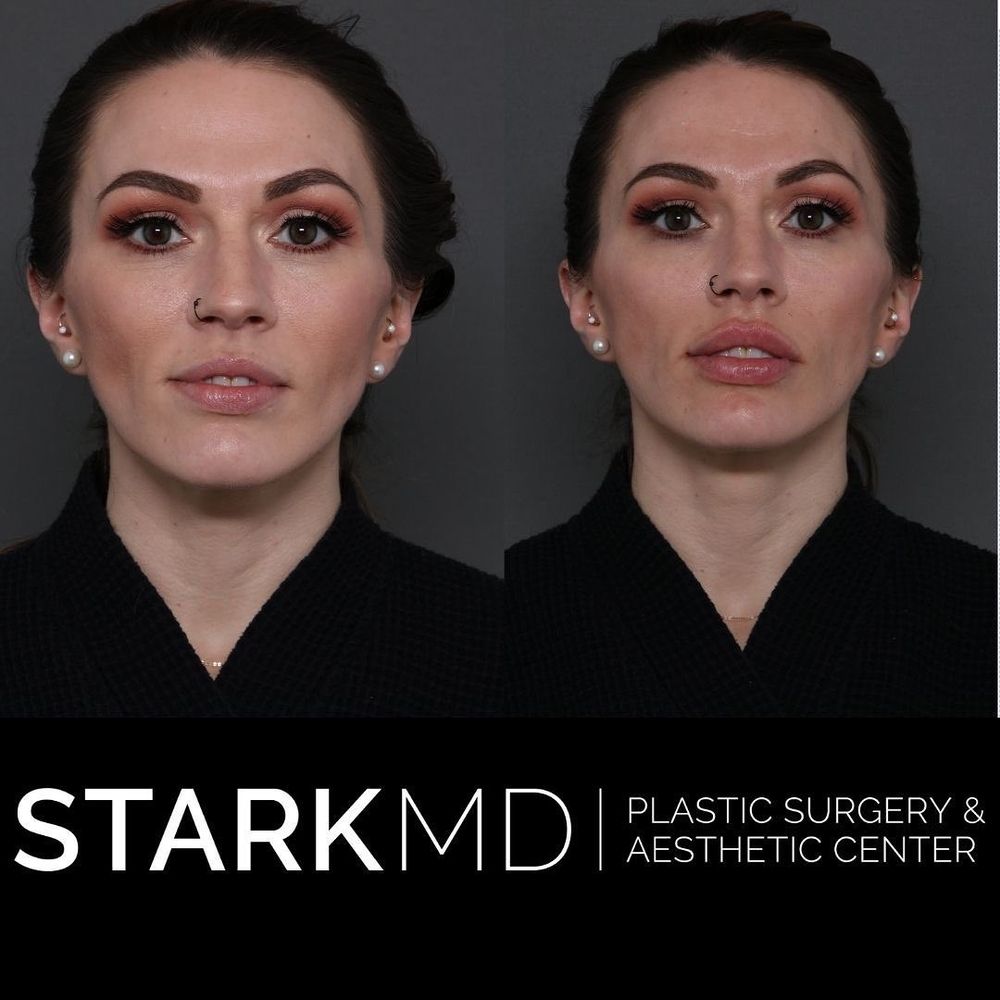STARKMD PLASTIC SURGERY & AESTHETIC CENTER 18 Photos 135 S Bryn
