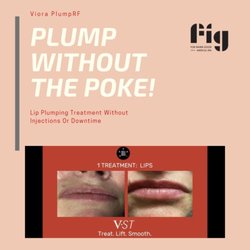 Fig Medical Spa - Tulsa - PlumpRF! Laser lip plumping without the poke! Visit our website for details!
