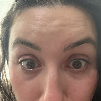 Ruhe Aesthetics - Not a month in and I have movement. - Medical Spas Near Me - Temecula, California Ruhe Aesthetics - Not a month in and I have movement. - Medical Spas Near Me - Temecula, California