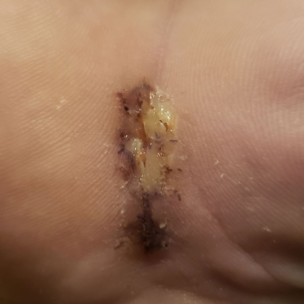 Uniontown Hospital - Dr also went on vacation when I was supposed to get stitches out without getting another Dr to cover his patient. And my hand got infected. - Hospitals Near Me - Uniontown, Pennsylvania
