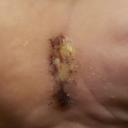 Uniontown Hospital - Dr also went on vacation when I was supposed to get stitches out without getting another Dr to cover his patient. And my hand got infected.