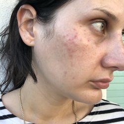 Christine Skin Care