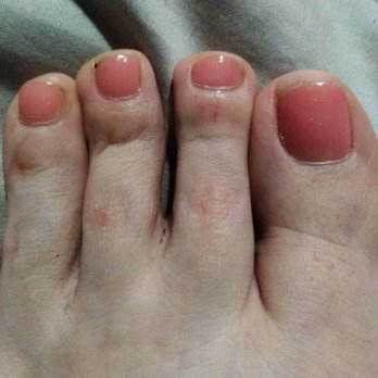 SanTan Nails & Spa - Left foot ouchies. Pardon my sock fuzz feet! - Nail Salons Near Me - Gilbert, Arizona SanTan Nails & Spa - Left foot ouchies. Pardon my sock fuzz feet! - Nail Salons Near Me - Gilbert, Arizona