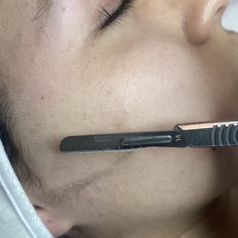 Turn Downtown - Dermaplaning is amazing!! Dermaplaning aims to make your skin's surface smooth, youthful, and radiant - Skin Care Near Me - Tucson, Arizona Turn Downtown - Dermaplaning is amazing!! Dermaplaning aims to make your skin's surface smooth, youthful, and radiant - Skin Care Near Me - Tucson, Arizona