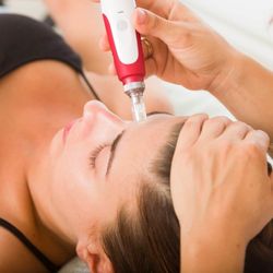 Transformations Esthetics & Wellness - Microneedling