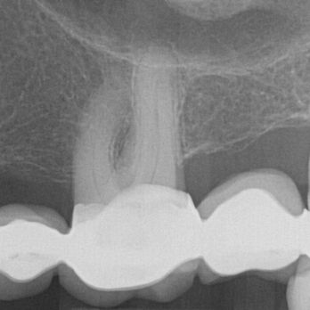 Welch Dentistry - A Crack ?? Nope - Cosmetic Dentists Near Me - Las Vegas, Nevada Welch Dentistry - A Crack ?? Nope - Cosmetic Dentists Near Me - Las Vegas, Nevada