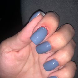 New Nichole Nail Spa - Infected nail