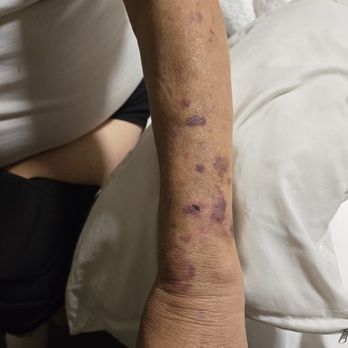 DM Injury Law - Personal Injury Law Near Me - St. Louis, Missouri DM Injury Law - Personal Injury Law Near Me - St. Louis, Missouri