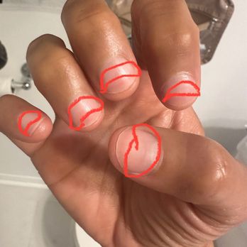 Josephine's Nail Spa - Red marks growing out from the damage done to my nails at this salon - Nail Salons Near Me - Studio City, California