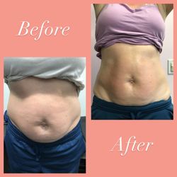 Eye Candy Body Sculpting - Target stubborn fat!