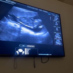 Heavenly 3D4D Ultrasound