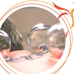 Health Rediscovered - cupping for muscle relaxation, healing from injury and boosting the immune system.