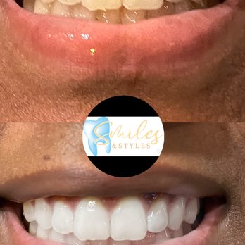 Smiles & Styles - Teeth Whitening Near Me - Houston, Texas Smiles & Styles - Teeth Whitening Near Me - Houston, Texas