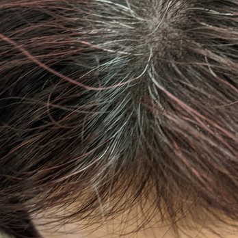 Crown Design - Finished density fill. - Hair Loss Centers Near Me - Denver, Colorado