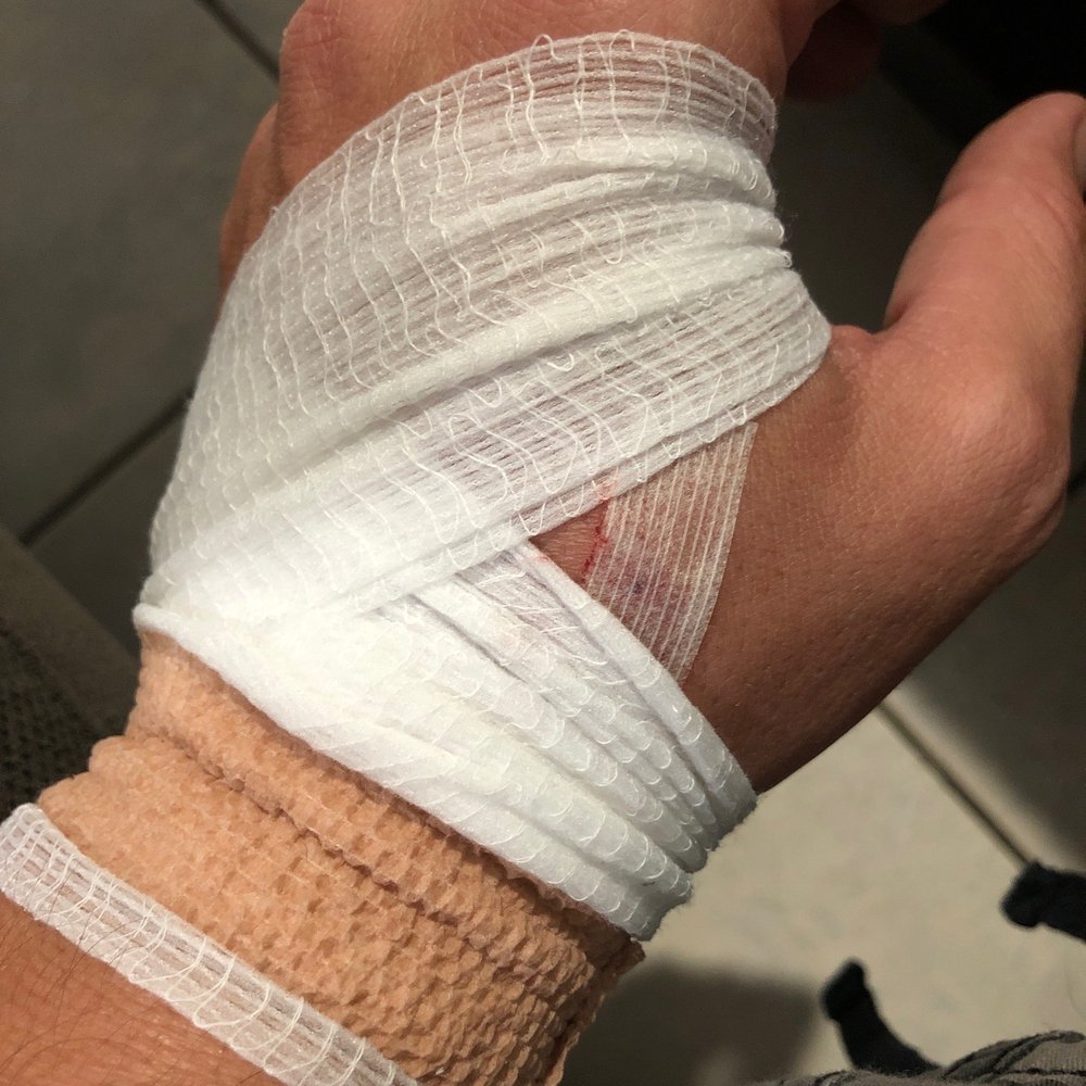 Bandaging fail. Bandaging fail.