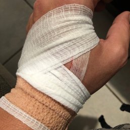 Bandaging fail. Bandaging fail.