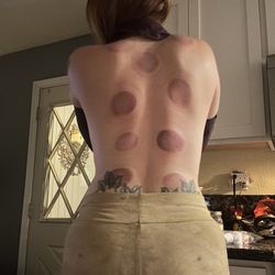 E Spa Massage - Cupping was much needed for me during this visit. Wish they had been able to move them around on my back but it still helped a lot.