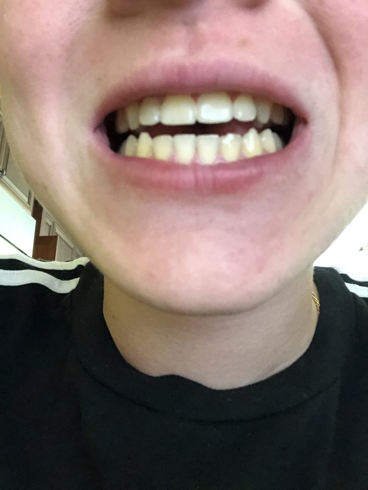 ROTHENBERG ORTHODONTICS 1129 Bloomfield Ave, West Caldwell, NJ Yelp