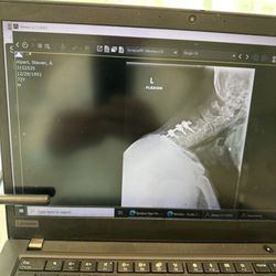 Kasra Rowshan, MD - Does this look like 90% up?