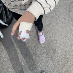 Warren Clinic - No break!! Just a bad jam/sprain. Buddy tape to heal her up!