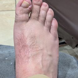 Van's Nail Salon - After: note the angelic nature of the foot with notes of cucumber aroma. Followup with a doctor was strongly advised by the technician.