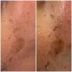 DK Beauty Bar - When taking care of your skin at home and in the treatment room helps correct skin concerns
