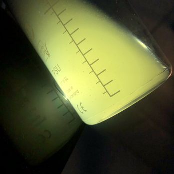 Erasable Med Spa - If you look close its all the yuck and blackheads... - Tattoo Removal Near Me - Tampa, Florida